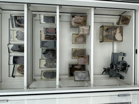 Foto Präparatevitrine Pathologie 2024